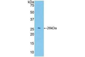 Western blot analysis of recombinant Mouse GSTa4. (GSTA4 Antikörper  (AA 1-222))