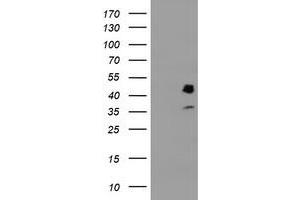 HEK293T cells were transfected with the pCMV6-ENTRY control (Left lane) or pCMV6-ENTRY PDSS2 (Right lane) cDNA for 48 hrs and lysed. (PDSS2 Antikörper)