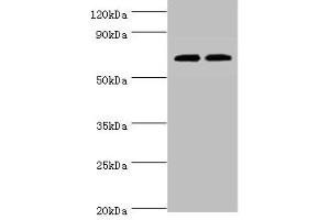 Western blot All lanes: APBB1IP antibody at 4 μg/mL Lane 1: HL60 whole cell lysate Lane 2: Rat spleen tissue Secondary Goat polyclonal to rabbit IgG at 1/10000 dilution Predicted band size: 74, 19 kDa Observed band size: 74 kDa (Amyloid beta (A4) Precursor Protein-Binding, Family B, Member 1 Interacting Protein (APBB1IP) (AA 1-150) Antikörper)