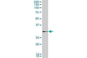 SIX3 monoclonal antibody (M02), clone 3F1. (SIX3 Antikörper  (AA 273-332))