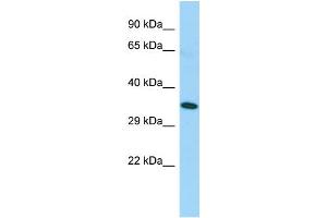 Host: Rabbit Target Name: TAS2R5 Sample Type: Fetal Lung lysates Antibody Dilution: 1. (TAS2R5 Antikörper  (C-Term))