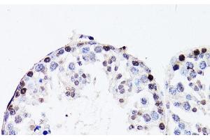 Immunohistochemistry of paraffin-embedded Mouse testis using FGF12 Polyclonal Antibody at dilution of 1:150 (40x lens). (FGF12 Antikörper)