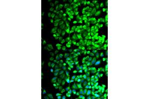 Immunofluorescence analysis of HeLa cells using TBXAS1 antibody. (TBXAS1 Antikörper)