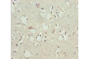 Immunohistochemistry of paraffin-embedded human brain tissue using ABIN7153645 at dilution of 1:100 (GAS2L1 Antikörper  (AA 130-400))