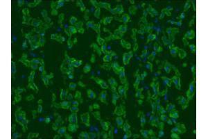 Image no. 2 for anti-Keratin 5/8 (KRT5/8) antibody (ABIN335325) (Keratin 5/8 Antikörper)