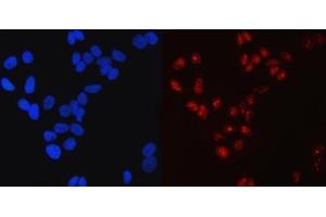 IF analysis of SP1 using anti-SP1 antibody (ABIN7601559). (SP1 Antikörper  (AA 384-603))