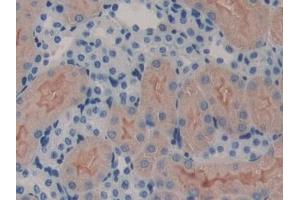 Detection of ErbB3 in Mouse Kidney Tissue using Polyclonal Antibody to V-Erb B2 Erythroblastic Leukemia Viral Oncogene Homolog 3 (ErbB3) (ERBB3 Antikörper  (AA 707-964))