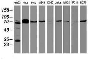 Image no. 3 for anti-B-Cell CLL/lymphoma 10 (BCL10) antibody (ABIN1496848) (BCL10 Antikörper)