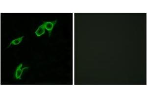 Immunofluorescence analysis of LOVO cells, using GPR75 Antibody. (GPR75 Antikörper  (AA 381-430))