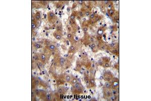 Immunohistochemistry (Paraffin-embedded Sections) (IHC (p)) image for anti-Fucosyltransferase 4 (Alpha (1,3) Fucosyltransferase, Myeloid-Specific) (FUT4) (AA 242-271) antibody (ABIN389262)