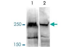 Western Blot analysis of (1) 150 ug nuclear extract of NIH3T3 cells, and (2) 150 ug nuclear extract of HeLa cells. (BAZ2A Antikörper)