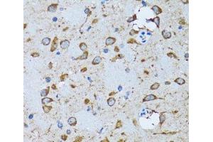 Immunohistochemistry of paraffin-embedded Mouse brain using PDP1 Polyclonal Antibody at dilution of 1:100 (40x lens). (PDP Antikörper)