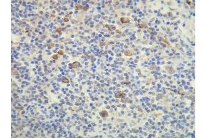 Immunohistochemistry (IHC) image for anti-Fucosyltransferase 4 (Alpha (1,3) Fucosyltransferase, Myeloid-Specific) (FUT4) (AA 28-49), (N-Term) antibody (ABIN7598789)