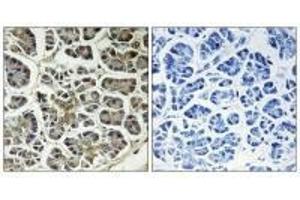 Immunohistochemistry analysis of paraffin-embedded human pancreas tissue using ATP5G2 antibody. (ATP5G2 Antikörper)