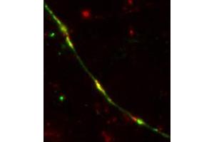 Image no. 3 for anti-TEV (Cut Protease Site) antibody (ABIN1742525) (TEV (Cut Protease Site) Antikörper)