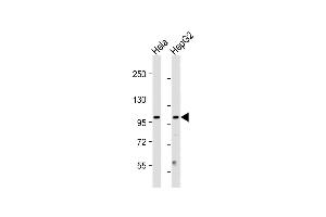 All lanes : Anti-NU Antibody (N-term) at 1:2000 dilution Lane 1: Hela whole cell lysate Lane 2: HepG2 whole cell lysate Lysates/proteins at 20 μg per lane. (NUP210 Antikörper  (N-Term))