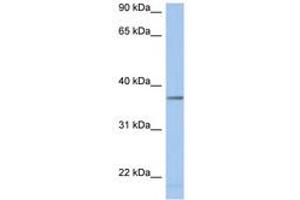 Image no. 1 for anti-Lactate Dehydrogenase A-Like 6B (LDHAL6B) (AA 251-300) antibody (ABIN6743763) (LDHAL6B Antikörper  (AA 251-300))