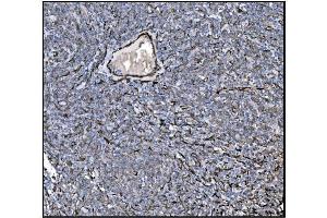 IHC analysis of TAGLN/Transgelin using anti-TAGLN/Transgelin antibody (ABIN7600099).