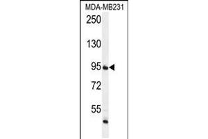 Western blot analysis in MDA-MB231 cell line lysates (35ug/lane). (FTSJ3 Antikörper  (AA 616-646))