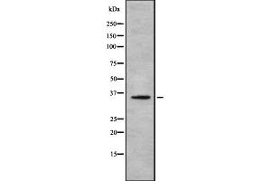 Western blot analysis of TAS2R60 using HepG2 whole cell lysates (TAS2R60 Antikörper  (Internal Region))