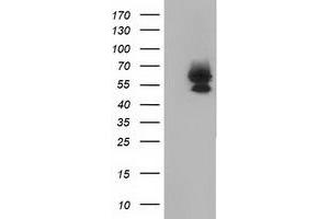 HEK293T cells were transfected with the pCMV6-ENTRY control (Left lane) or pCMV6-ENTRY BEST3 (Right lane) cDNA for 48 hrs and lysed. (Bestrophin 3 Antikörper)