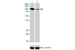 Western blot analysis of SYNJ2 over-expressed 293 cell line, cotransfected with SYNJ2 Validated Chimera RNAi (Lane 2) or non-transfected control (Lane 1).