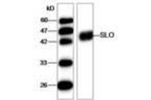 Image no. 1 for anti-Streptolysin O (SLO) (AA 78-206) antibody (ABIN791625) (Streptolysin O Antikörper  (AA 78-206))