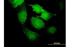 Immunofluorescence of purified MaxPab antibody to EPB41L2 on HeLa cell.