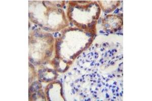 Formalin fixed and paraffin embedded human kidney tissue stained with STARD4 Antibody (N-term) Cat. (STARD4 Antikörper  (N-Term))