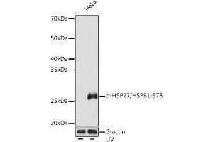 Western blot analysis of extracts of HeLa cells, using Phospho-HSP27/HSPB1-S78 Rabbit mAb (ABIN7267570) at 1:1000 dilution. (HSP27 Antikörper  (pSer78))