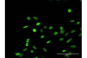 Immunofluorescence of purified MaxPab antibody to RPA1 on HeLa cell.