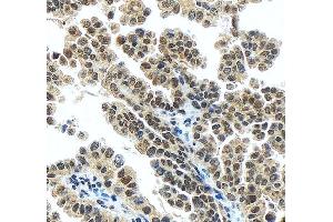 IHC analysis of DR1 using anti-DR1 antibody (ABIN7602313).