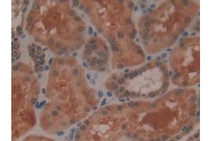 Immunohistochemistry (IHC) image for anti-Glutathione Peroxidase 4 (GPX4) (AA 74-197) antibody (ABIN7438652)