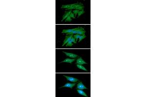 ICC/IF analysis of PDCL3 in HeLa cells line, stained with DAPI (Blue) for nucleus staining and monoclonal anti-human PDCL3 antibody (1:100) with goat anti-mouse IgG-Alexa fluor 488 conjugate (Green). (PDCL3 Antikörper)