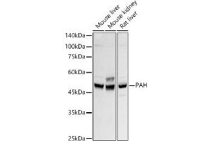 Western blot analysis of extracts of various cell lines, using PAH antibody (ABIN7269264) at 1:500 dilution. (Phenylalanine Hydroxylase Antikörper)