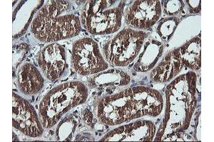 Image no. 2 for anti-DEAD (Asp-Glu-Ala-Asp) Box Polypeptide 58 (DDX58) antibody (ABIN1500708) (DDX58 Antikörper)