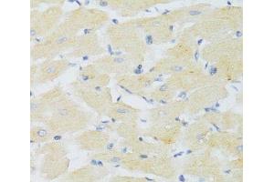 Immunohistochemistry of paraffin-embedded Mouse heart using CXCR3 Polyclonal Antibody at dilution of 1:100 (40x lens).