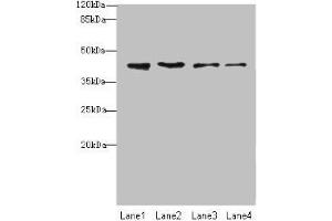 Western blot All lanes: NUP43 antibody at 4 μg/mL Lane 1: A431 whole cell lysate Lane 2: HL60 whole cell lysate Lane 3: THP-1 whole cell lysate Lane 4: A549 whole cell lysate Secondary Goat polyclonal to rabbit IgG at 1/10000 dilution Predicted band size: 43, 32 kDa Observed band size: 43 kDa (NUP43 Antikörper  (AA 1-200))