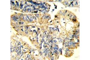 Immunohistochemistry (IHC) image for anti-Leukemia Inhibitory Factor (LIF) (AA 72-101) antibody (ABIN3031614)