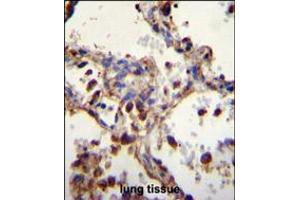 WDR52 Antibody immunohistochemistry analysis in formalin fixed and paraffin embedded human lung tissue followed by peroxidase conjugation of the secondary antibody and DAB staining. (WDR52 Antikörper  (C-Term))