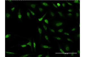 Immunofluorescence of monoclonal antibody to SNAPC4 on HeLa cell. (SNAPC4 Antikörper  (AA 53-162))