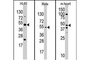 Western blot analysis of JMJD6 polyclonal antibody  in mouse heart, Hela, and HL-60 cell line lysates. (JMJD6 Antikörper  (N-Term))