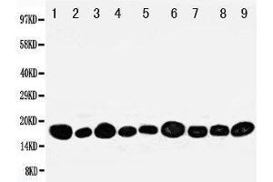Western Blotting (WB) image for anti-Nucleoside diphosphate kinase B (NME2) (AA 137-152), (C-Term) antibody (ABIN3044198)