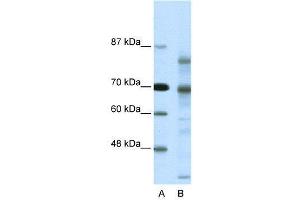 WB Suggested Anti-NCOR2  Antibody Titration: 0. (NCOR2 Antikörper  (N-Term))