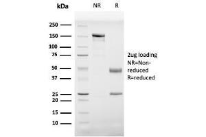 SDS-PAGE Analysis Purified Prohibitin Mouse Monoclonal Antibody (PHB/3229). (Prohibitin Antikörper  (AA 167-261))