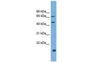 Image no. 1 for anti-DnaJ (Hsp40) Homolog, Subfamily A, Member 2 (DNAJA2) (AA 35-84) antibody (ABIN6744936)