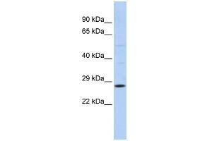 WB Suggested Anti-RAB38 Antibody Titration:  0. (RAB38 Antikörper  (N-Term))