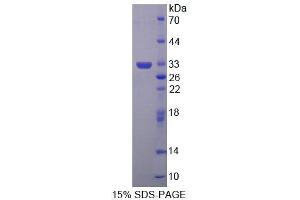 SDS-PAGE (SDS) image for 4-Aminobutyrate Aminotransferase (ABAT) (AA 249-500) protein (His tag) (ABIN6239350)