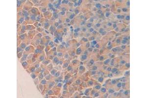 Used in DAB staining on fromalin fixed paraffin- embedded Kidney tissue (STAT1 Antikörper  (AA 432-680))