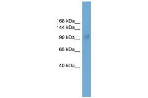 WB Suggested Anti-Lbxcor1 Antibody Titration:  0. (SKOR1 Antikörper  (Middle Region))